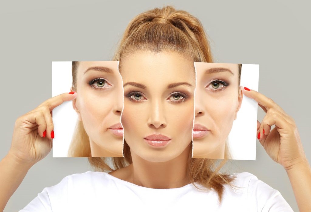 Laugh lines fillers in Islamabad, smile lines fillers, laugh lines filler before and after, laugh lines filler cost