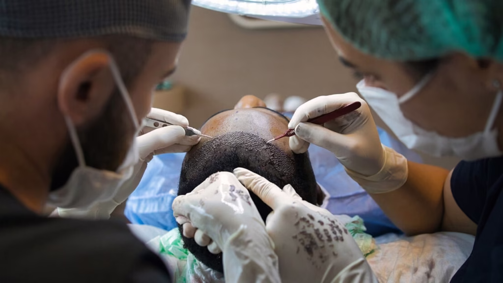 Best hair transplant in Islamabad