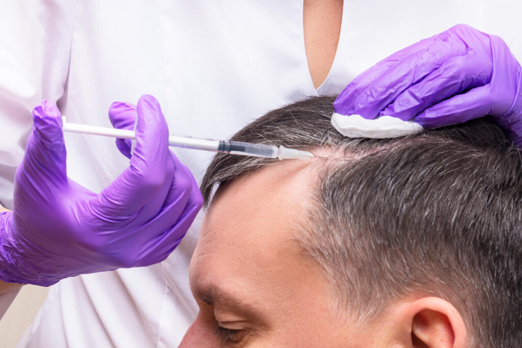 Best PRP hair treatment in Islamabad